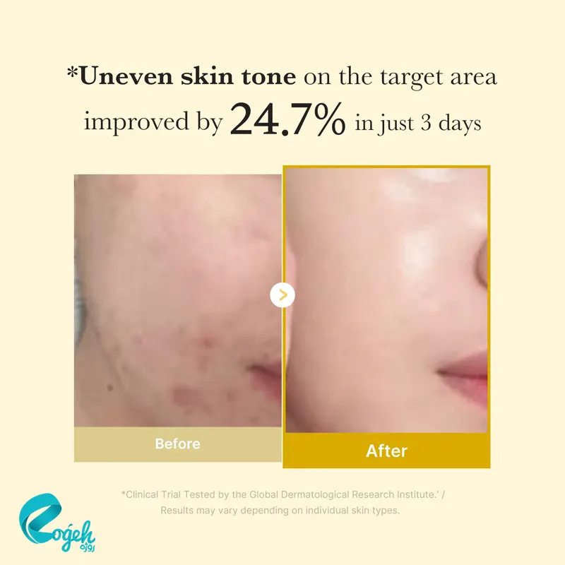 ماسک روشن کننده کوجیک اسید و زردچوبه مدی کیوب ۷۵ میل