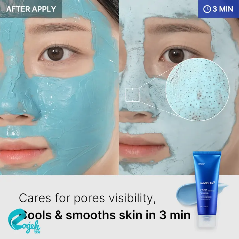 ماسک کنترل منافذ و جوش سرسیاه مدی کیوب ۱۰۰ گرم