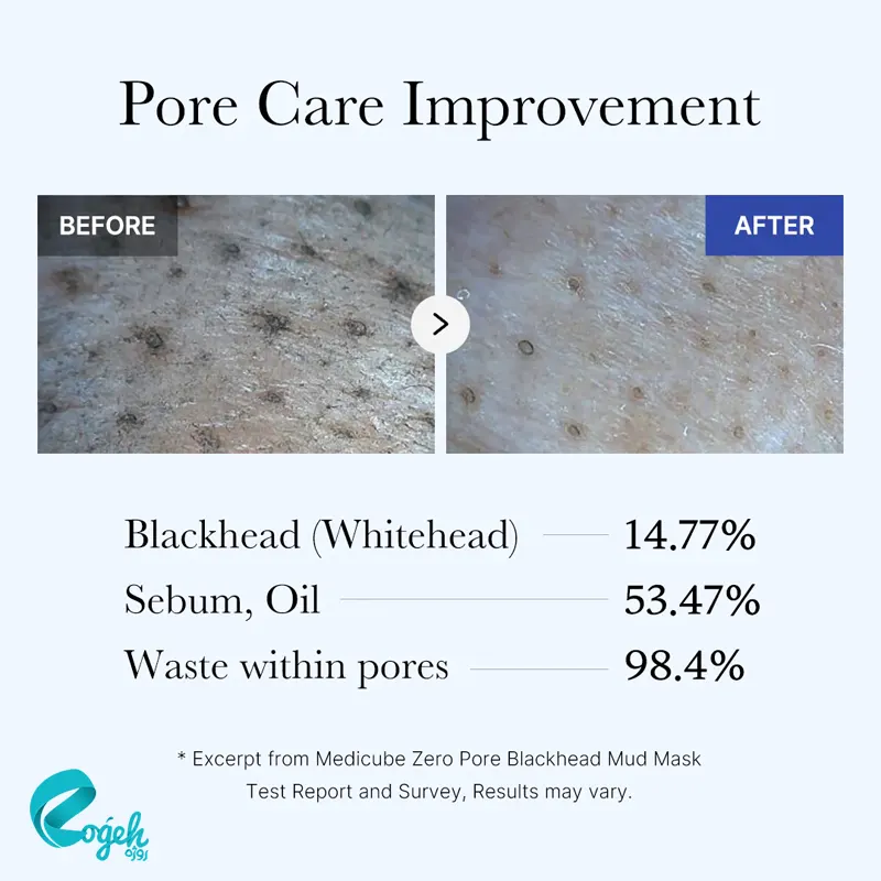 ماسک کنترل منافذ و جوش سرسیاه مدی کیوب ۱۰۰ گرم