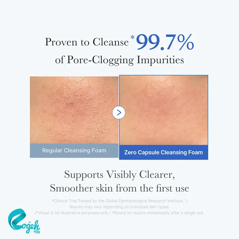 فوم شوینده کپسولی سالیسیلیک اسید مدی کیوب ۱۲۰ گرم